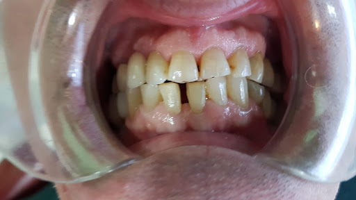 Clínica Dental Álvarez - De Frutos
