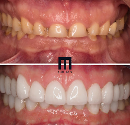 Clínica Guitián Clínica Dental en Vigo Implantes Ortodoncia Estética