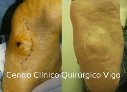 Centro Clinico Quirurgico Vigo